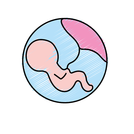 What Does Hypnobirthing Involve?